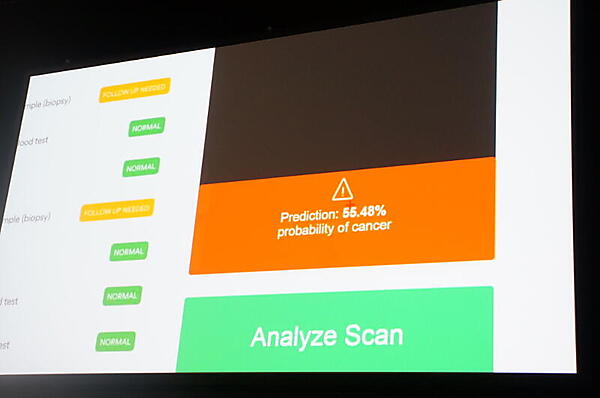 CTスキャンの画像解析で肺ガンの可能性をパーセンテージで表示するアプリ