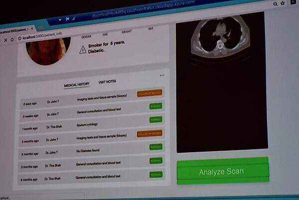 SQL Server 2017に入ったCTスキャン画像からAIで診断