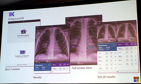 大量の画像から肺炎を発見するDiagnostiX