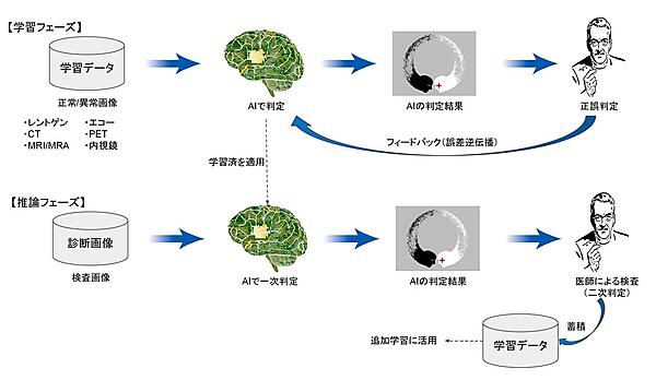 ディープラーニングによる画像診断の学習と推論